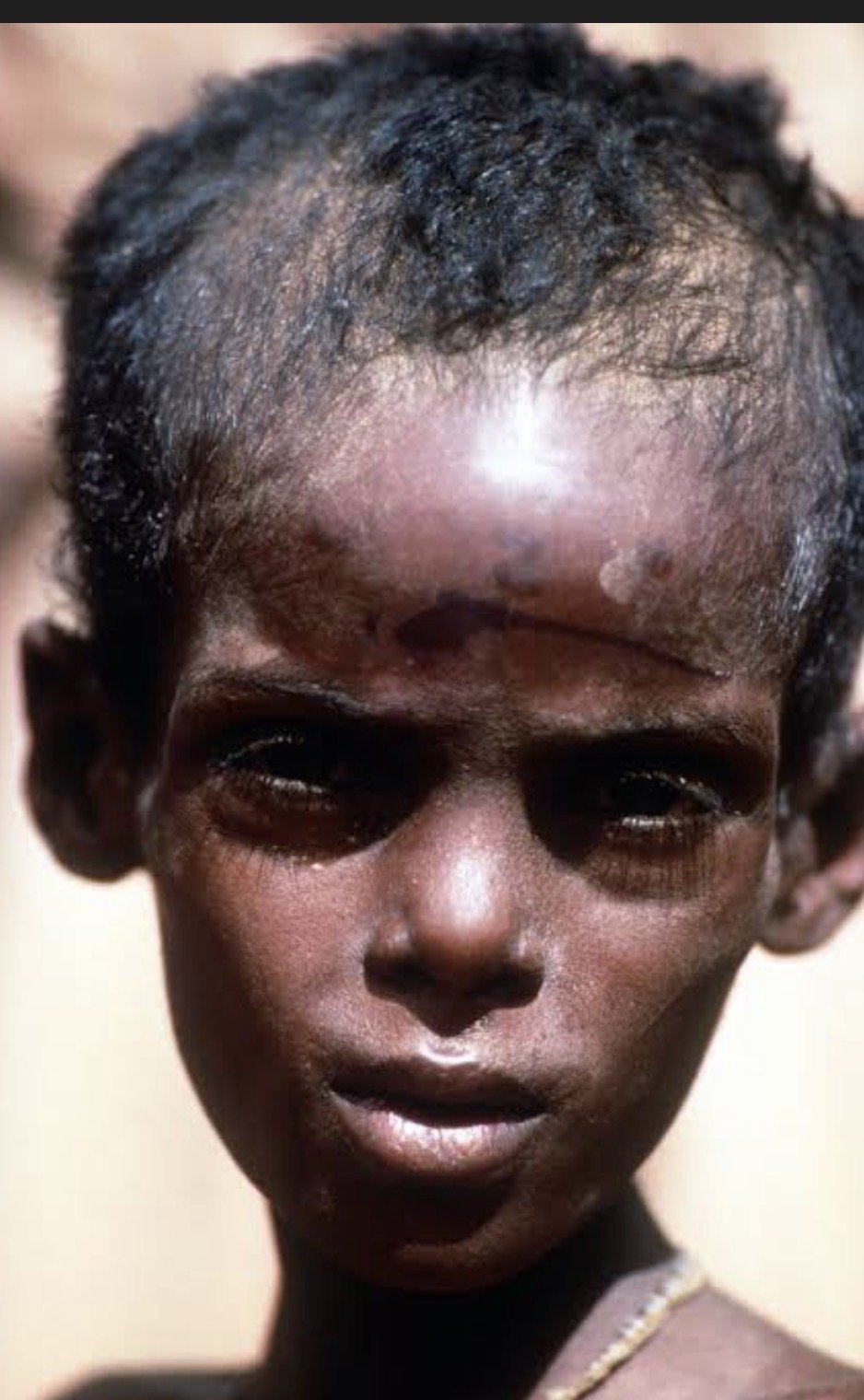 somalianKing